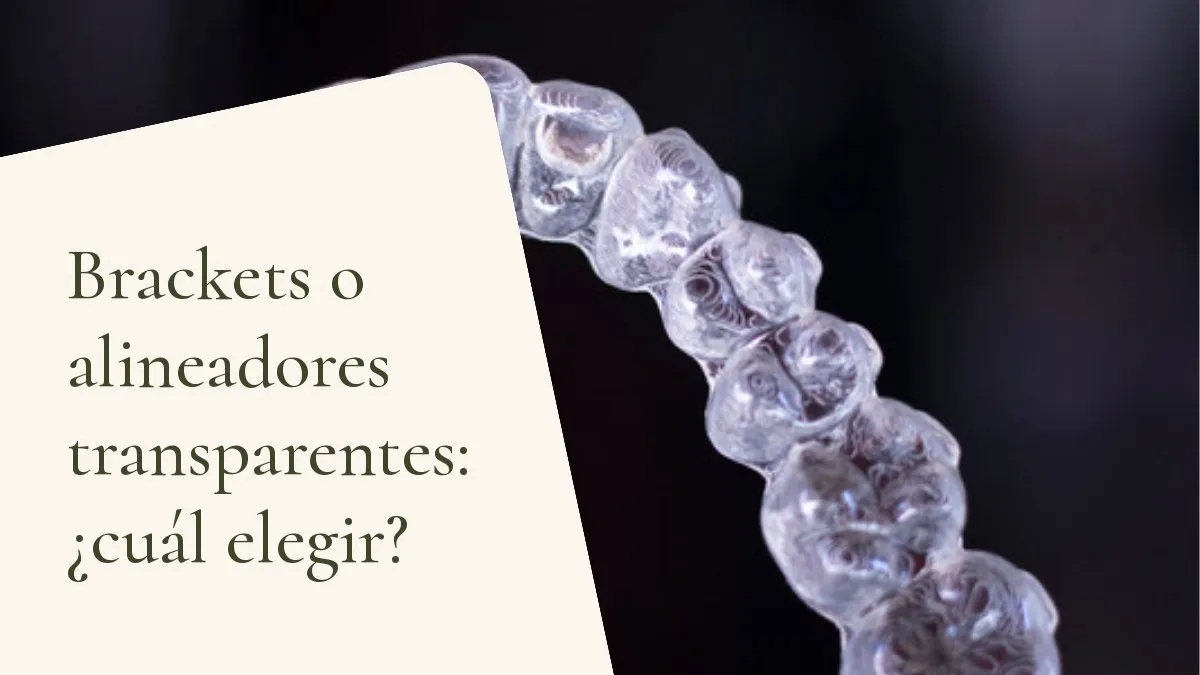 Objetos de odontología relacionados con el tema sobre una superficie clara — portada del artículo 'Brackets o alineadores transparentes: ¿cuál elegir?', del consultorio de la Dra. Cléo Salustiano, dentista en la Mooca, São Paulo.