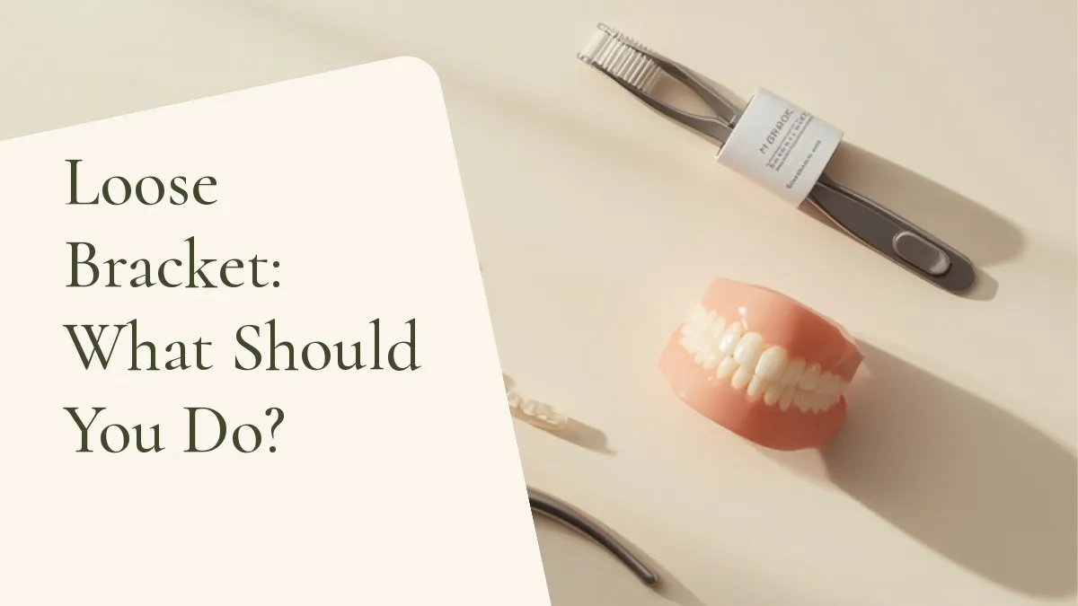 Dental items related to the topic on a light surface — cover of the article 'Loose Bracket: What Should You Do?', from the dental office of Dr. Cléo Salustiano, a dentist in Mooca, São Paulo.