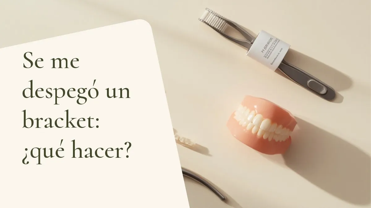 Objetos de odontología relacionados con el tema sobre una superficie clara — portada del artículo 'Se me despegó un bracket: ¿qué hacer?', del consultorio de la Dra. Cléo Salustiano, dentista en la Mooca, São Paulo.