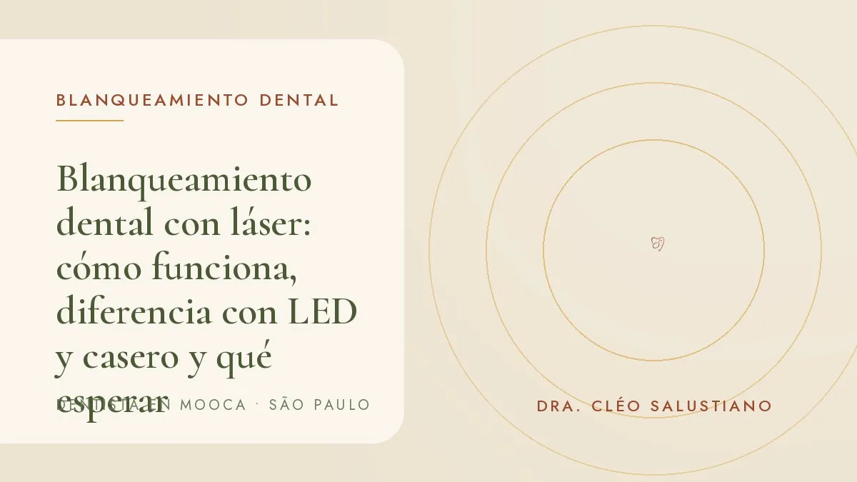 Sesión de blanqueamiento dental en consultorio, con gel sobre los dientes y luz de activación — portada del artículo 'Blanqueamiento dental con láser: cómo funciona, diferencia con LED y casero y qué esperar', del consultorio de la Dra. Cléo Salustiano, dentista en Mooca, São Paulo.