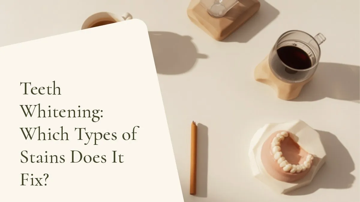 Dental items related to the topic on a light surface — cover of the article 'Teeth Whitening: Which Types of Stains Does It Fix?', from the dental office of Dr. Cléo Salustiano, a dentist in Mooca, São Paulo.