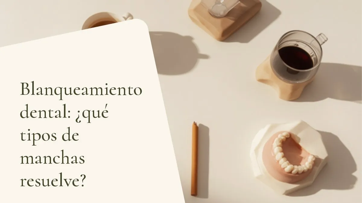 Objetos de odontología relacionados con el tema sobre una superficie clara — portada del artículo 'Blanqueamiento dental: ¿qué tipos de manchas resuelve?', del consultorio de la Dra. Cléo Salustiano, dentista en la Mooca, São Paulo.
