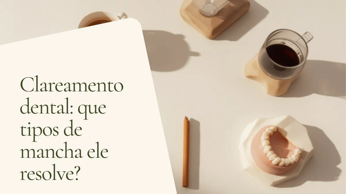 Objetos de odontologia relacionados ao tema sobre superfície clara — capa do artigo 'Clareamento dental: que tipos de mancha ele resolve?', do consultório da Dra. Cléo Salustiano, dentista na Mooca, São Paulo.