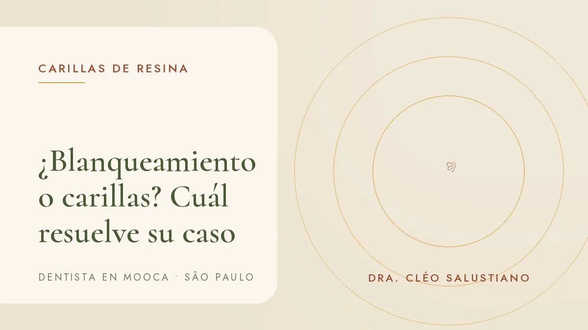Guía de colores dental junto a una sonrisa — portada del artículo '¿Blanqueamiento o carillas? Cuál resuelve su caso', del consultorio de la Dra. Cléo Salustiano, dentista en Mooca, São Paulo.