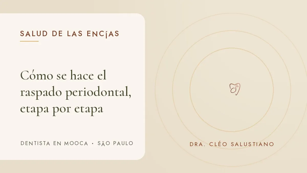Objetos de odontología sobre una superficie clara — portada del artículo 'Cómo se hace el raspado periodontal, etapa por etapa', del consultorio de la Dra. Cléo Salustiano, dentista en Mooca, São Paulo.