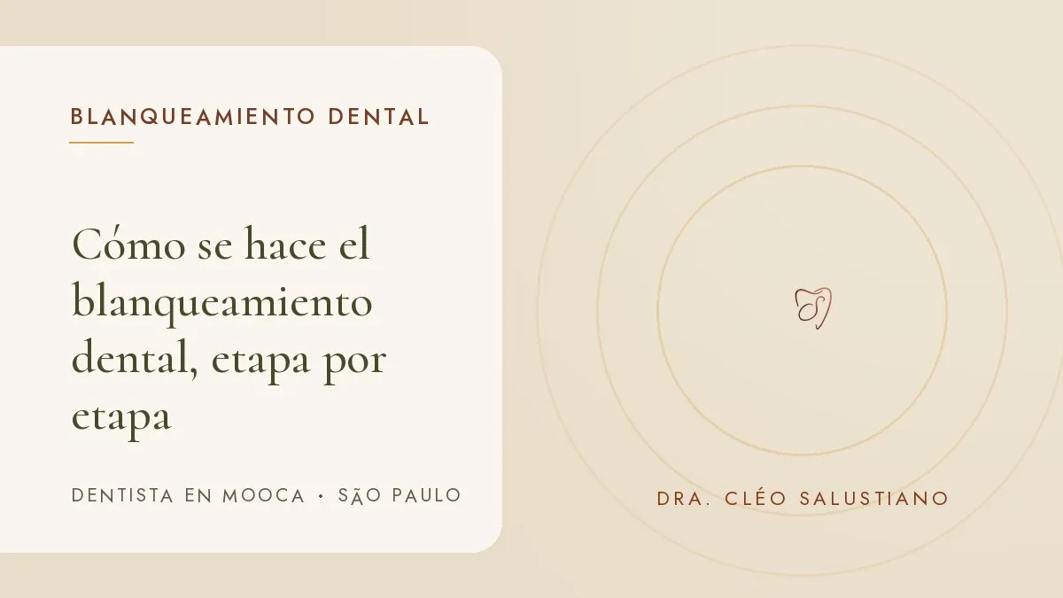 Objetos de odontología estética sobre una superficie clara — portada del artículo 'Cómo se hace el blanqueamiento dental, etapa por etapa', del consultorio de la Dra. Cléo Salustiano, dentista en Mooca, São Paulo.