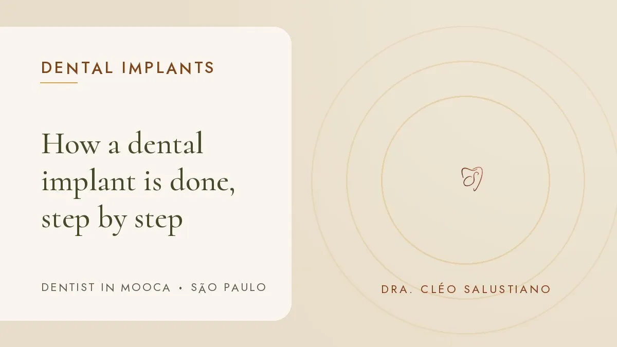Dental items on a light surface — cover of the article 'How a dental implant is done, step by step', from the dental office of Dr. Cléo Salustiano, dentist in Mooca, São Paulo.
