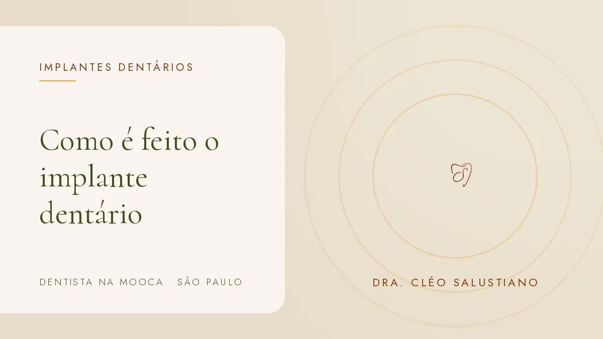 Objetos de odontologia sobre superfície clara — capa do artigo 'Como é feito o implante dentário', do consultório da Dra. Cléo Salustiano, dentista na Mooca, São Paulo.