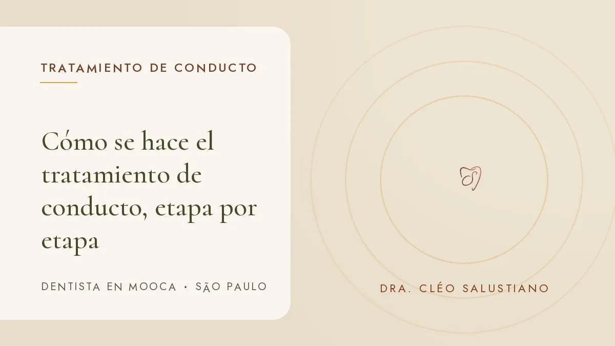 Objetos de odontología sobre una superficie clara — portada del artículo 'Cómo se hace el tratamiento de conducto, etapa por etapa', del consultorio de la Dra. Cléo Salustiano, dentista en Mooca, São Paulo.