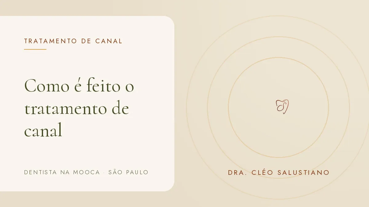 Objetos de odontologia sobre superfície clara — capa do artigo 'Como é feito o tratamento de canal', do consultório da Dra. Cléo Salustiano, dentista na Mooca, São Paulo.