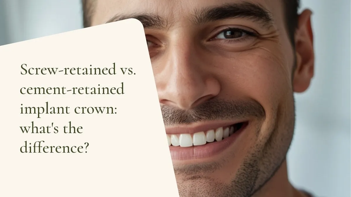 Dental objects related to the topic on a light surface — cover of the article 'Screw-retained vs. cement-retained implant crown: what's the difference?', from the dental office of Dr. Cléo Salustiano, a dentist in Mooca, São Paulo.