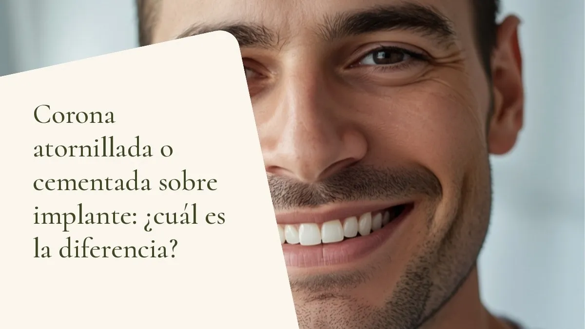 Objetos odontológicos relacionados con el tema sobre una superficie clara — portada del artículo 'Corona atornillada o cementada sobre implante: ¿cuál es la diferencia?', del consultorio de la Dra. Cléo Salustiano, dentista en Mooca, São Paulo.