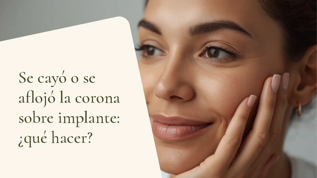 Objetos odontológicos relacionados con el tema sobre una superficie clara — portada del artículo 'Se cayó o se aflojó la corona sobre implante: ¿qué hacer?', del consultorio de la Dra. Cléo Salustiano, dentista en Mooca, São Paulo.