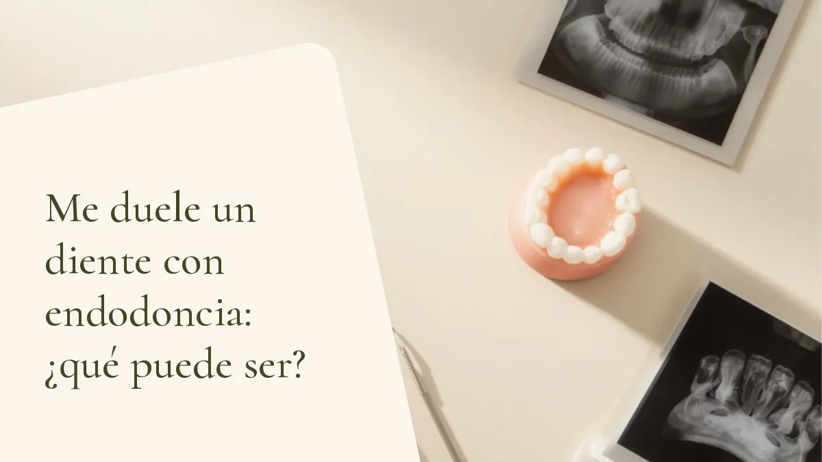 Objetos odontológicos relacionados con el tema sobre una superficie clara — portada del artículo 'Me duele un diente con endodoncia: ¿qué puede ser?', del consultorio de la Dra. Cléo Salustiano, dentista en Mooca, São Paulo.