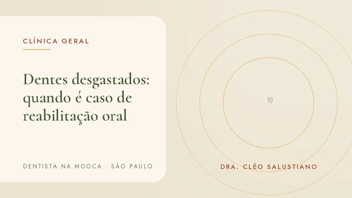 Capa do artigo 'Dentes desgastados ou curtos: quando o caso é de reabilitação oral', do consultório da Dra. Cléo Salustiano, dentista na Mooca, São Paulo.