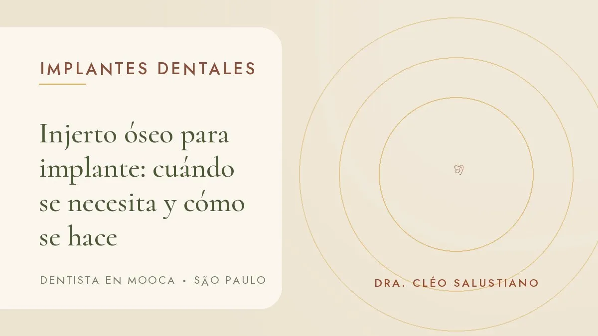 Portada del artículo 'Injerto óseo para implante: cuándo se necesita y cómo se hace', del consultorio de la Dra. Cléo Salustiano, dentista en Mooca, São Paulo.