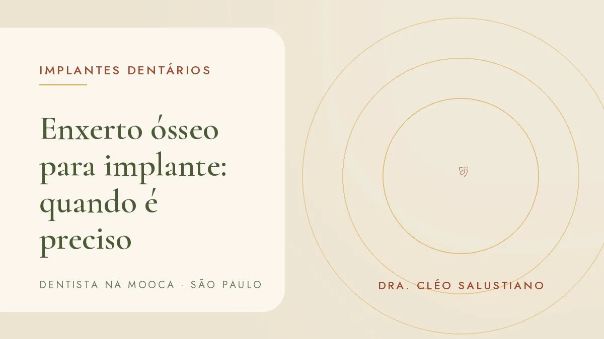 Capa do artigo 'Enxerto ósseo para implante: quando é preciso e como é feito', do consultório da Dra. Cléo Salustiano, dentista na Mooca, São Paulo.
