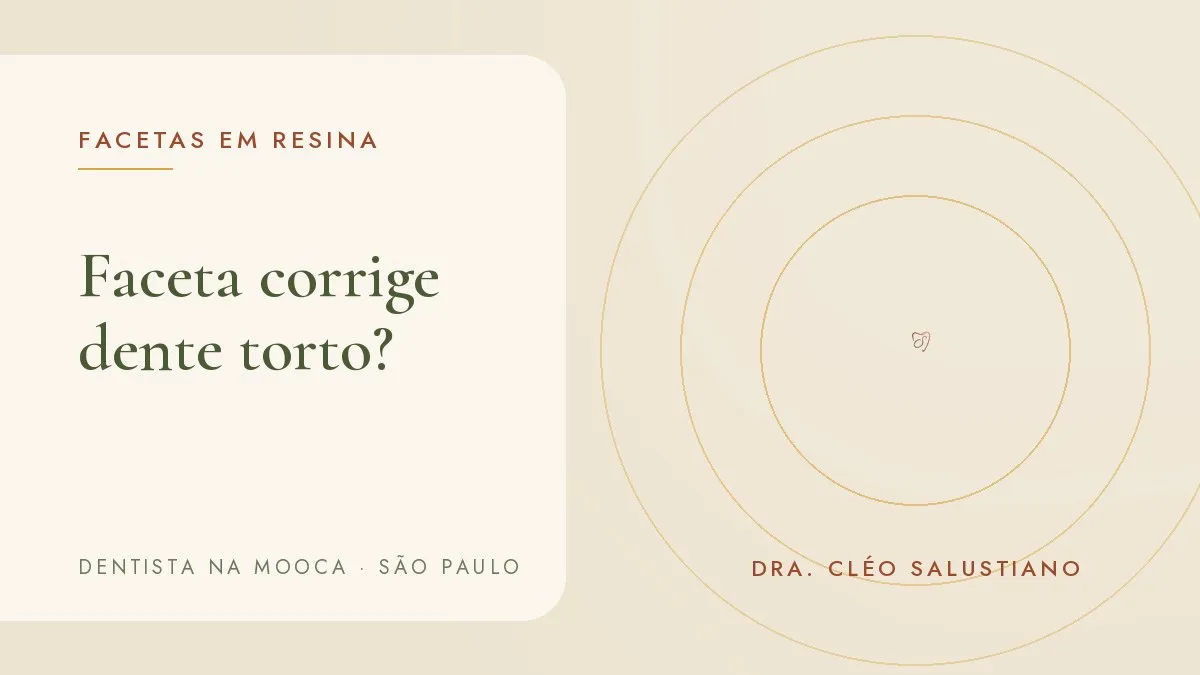 Capa do artigo 'Faceta corrige dente torto? Quando o aparelho vem antes', do consultório da Dra. Cléo Salustiano, dentista na Mooca, São Paulo.