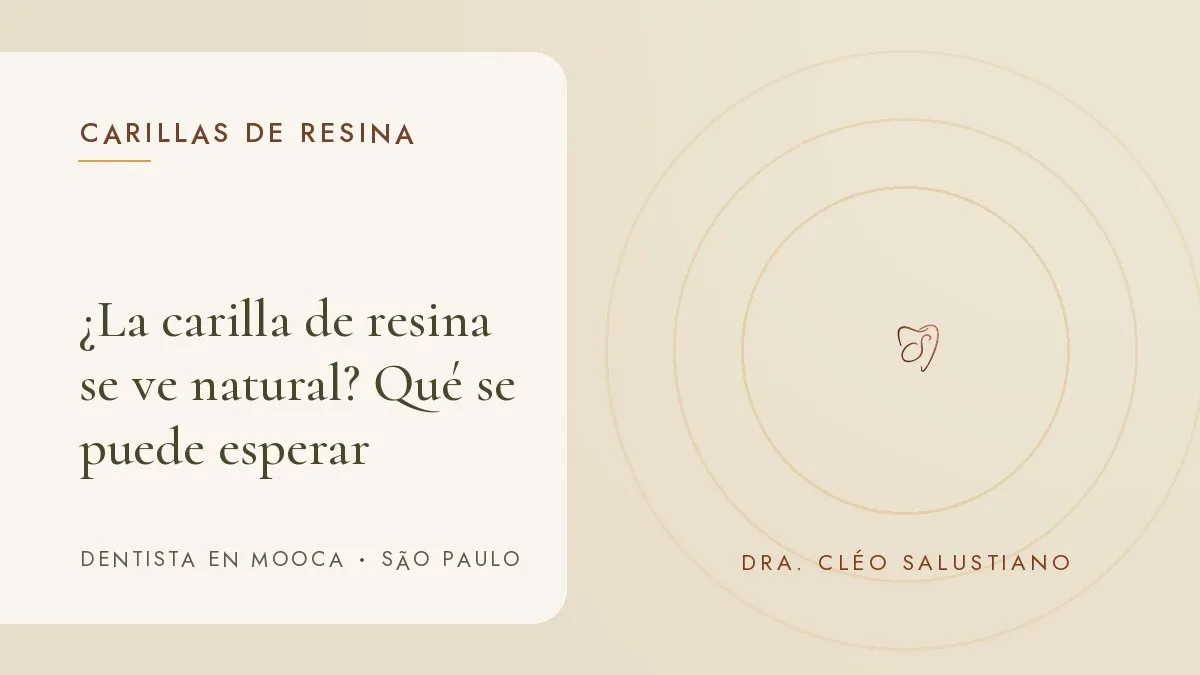 Objetos de odontología estética sobre una superficie clara — portada del artículo '¿La carilla de resina se ve natural?', del consultorio de la Dra. Cléo Salustiano, dentista en Mooca, São Paulo.