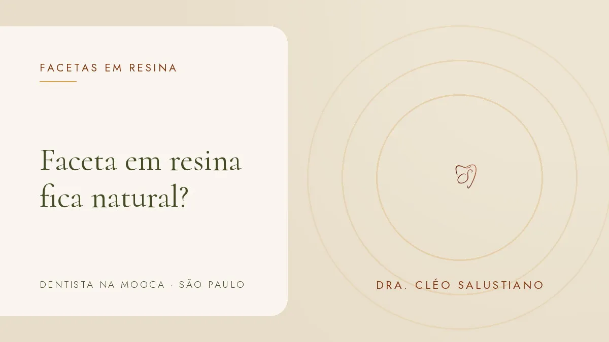 Objetos de odontologia estética sobre superfície clara — capa do artigo 'Faceta em resina fica natural?', do consultório da Dra. Cléo Salustiano, dentista na Mooca, São Paulo.