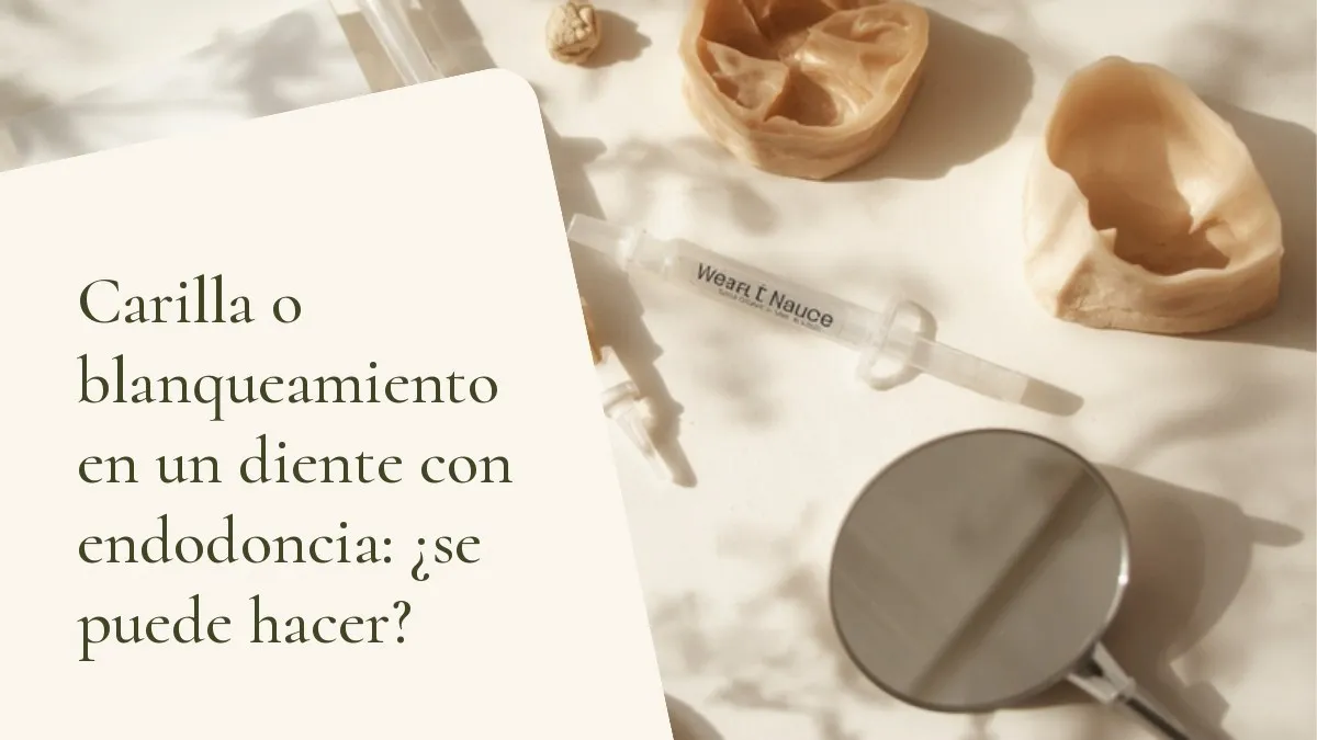 Objetos de odontología relacionados con el tema sobre una superficie clara — portada del artículo 'Carilla o blanqueamiento en un diente con endodoncia: ¿se puede hacer?', del consultorio de la Dra. Cléo Salustiano, dentista en Mooca, São Paulo.
