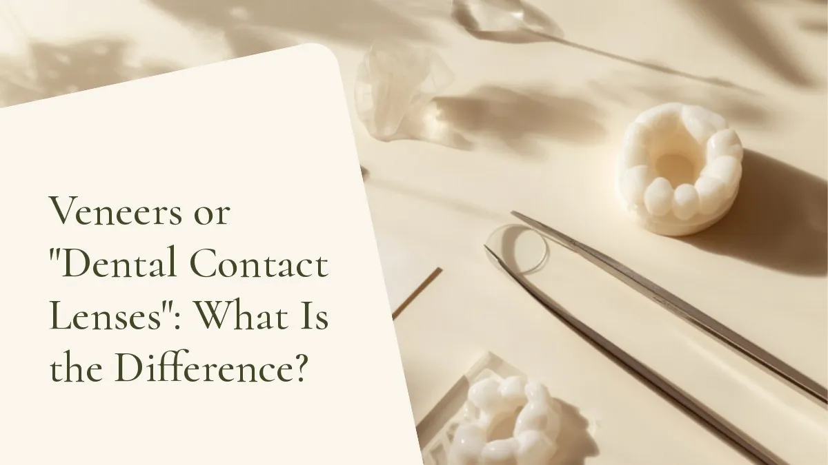 Dental items related to the topic on a light surface — cover of the article 'Veneers or Dental Contact Lenses: What Is the Difference?', from the dental office of Dr. Cléo Salustiano, a dentist in Mooca, São Paulo.