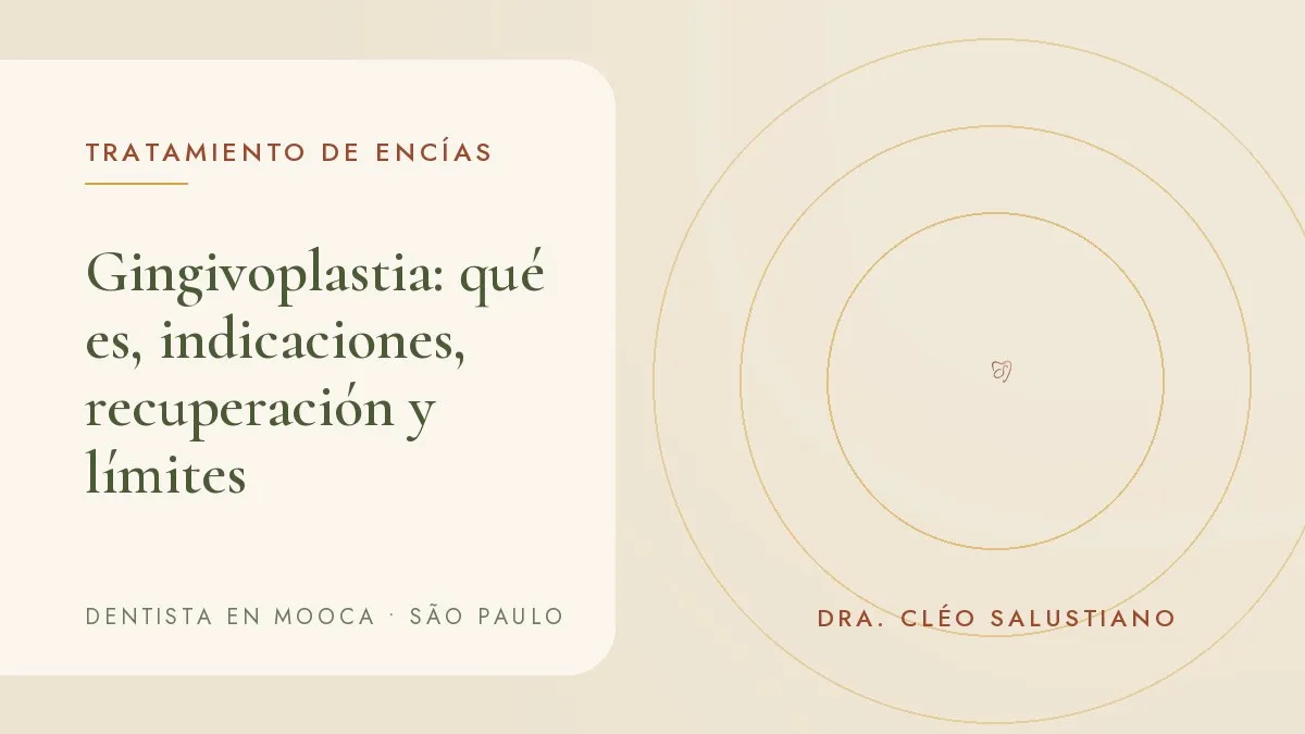 Sonrisa con contorno de encía armonioso — portada del artículo 'Gingivoplastia: qué es, indicaciones, recuperación y límites', del consultorio de la Dra. Cléo Salustiano, dentista en Mooca, São Paulo.