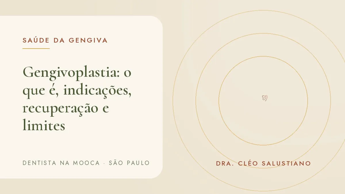 Sorriso com contorno de gengiva harmonioso — capa do artigo 'Gengivoplastia: o que é, indicações, recuperação e limites', do consultório da Dra. Cléo Salustiano, dentista na Mooca, São Paulo.