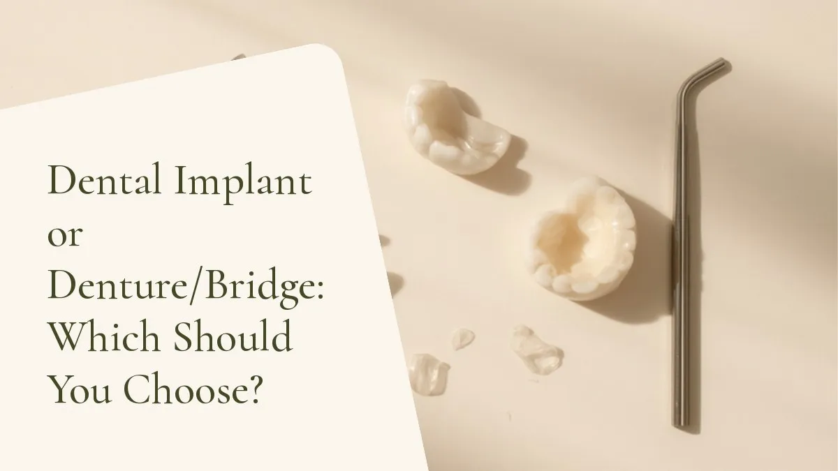 Dental items related to the topic on a light surface — cover of the article 'Dental Implant or Denture/Bridge: Which Should You Choose?', from the dental office of Dr. Cléo Salustiano, dentist in Mooca, São Paulo.