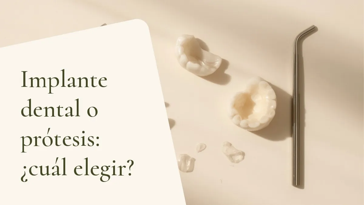 Objetos de odontología relacionados con el tema sobre una superficie clara — portada del artículo 'Implante dental o prótesis: ¿cuál elegir?', del consultorio de la Dra. Cléo Salustiano, dentista en Mooca, São Paulo.