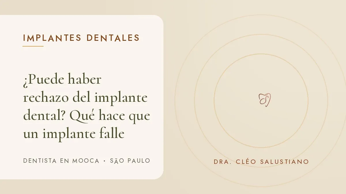 Objetos de odontología sobre una superficie clara — portada del artículo '¿Puede haber rechazo del implante dental?', del consultorio de la Dra. Cléo Salustiano, dentista en Mooca, São Paulo.