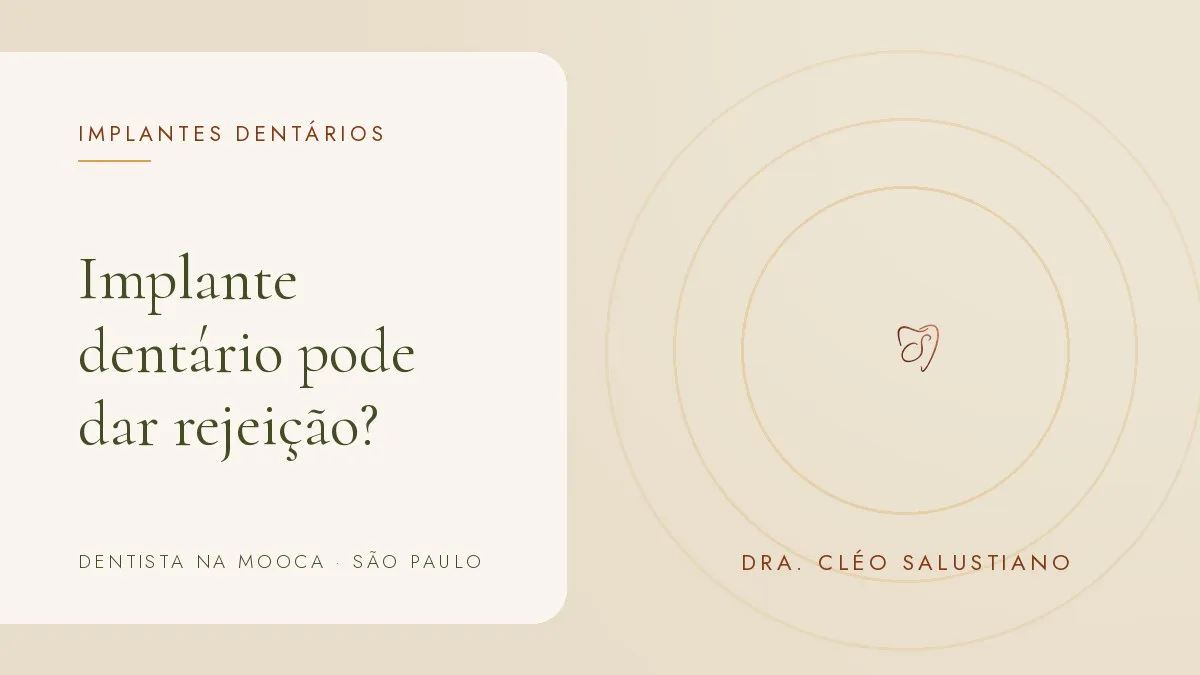 Objetos de odontologia sobre superfície clara — capa do artigo 'Implante dentário pode dar rejeição?', do consultório da Dra. Cléo Salustiano, dentista na Mooca, São Paulo.