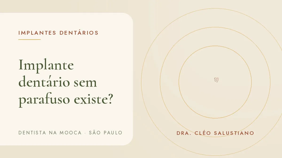 Capa do artigo 'Implante dentário sem parafuso existe? O que esse nome quer dizer', do consultório da Dra. Cléo Salustiano, dentista na Mooca, São Paulo.
