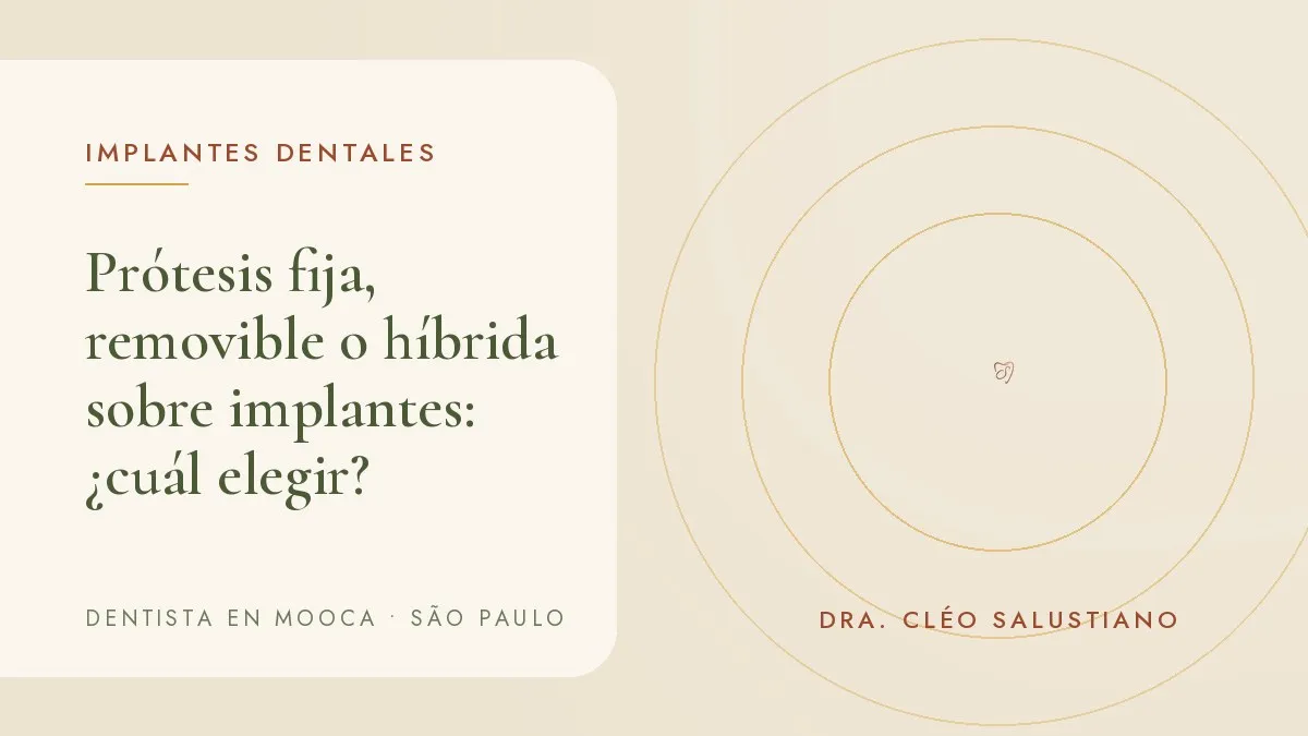Prótesis removible y modelo de prótesis híbrida sobre implantes lado a lado — portada del artículo 'Prótesis fija, removible o híbrida sobre implantes: ¿cuál elegir?', del consultorio de la Dra. Cléo Salustiano, dentista en Mooca, São Paulo.