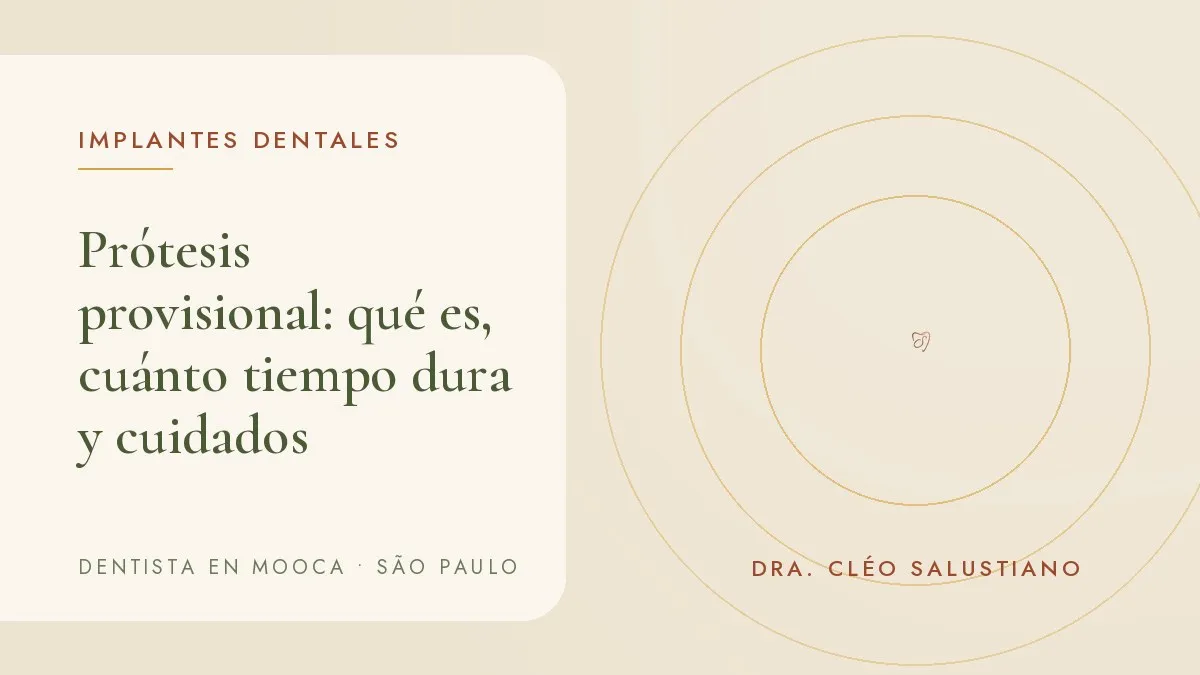 Corona provisional de resina junto a un modelo de arcada dental — portada del artículo 'Prótesis provisional: qué es, cuánto tiempo dura y cuidados', del consultorio de la Dra. Cléo Salustiano, dentista en Mooca, São Paulo.