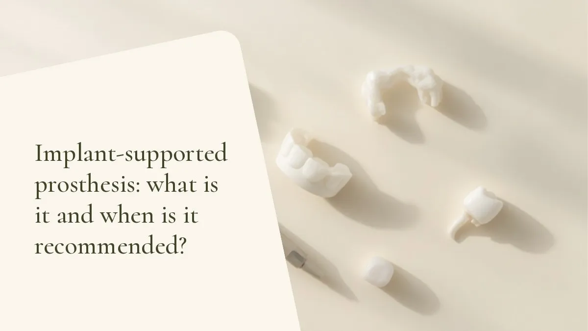 Dental items related to the topic on a light surface — cover of the article 'Implant-supported prosthesis: what is it and when is it recommended?', from the office of Dr. Cléo Salustiano, dentist in Mooca, São Paulo.