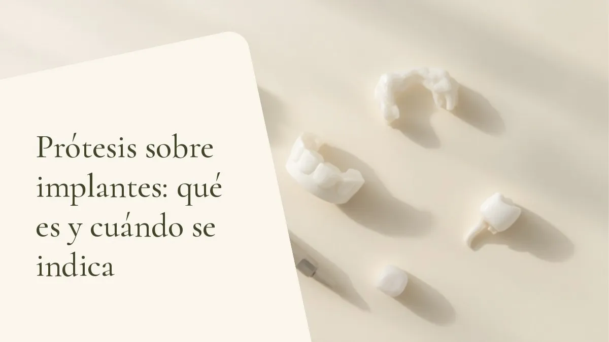 Instrumentos de odontología relacionados con el tema sobre una superficie clara — portada del artículo 'Prótesis sobre implantes: qué es y cuándo se indica', del consultorio de la Dra. Cléo Salustiano, dentista en Mooca, São Paulo.