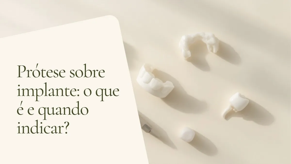 Objetos de odontologia relacionados ao tema sobre superfície clara — capa do artigo 'Prótese sobre implante: o que é e quando indicar?', do consultório da Dra. Cléo Salustiano, dentista na Mooca, São Paulo.