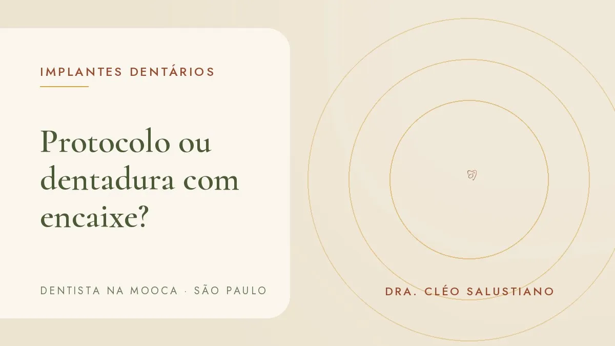 Capa do artigo 'Protocolo ou dentadura com encaixe: qual escolher quando faltam todos os dentes', do consultório da Dra. Cléo Salustiano, dentista na Mooca, São Paulo.