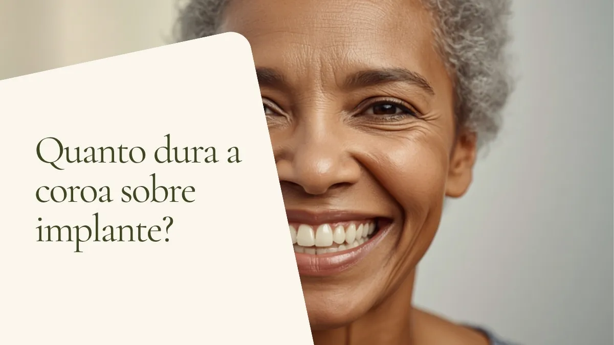 Objetos de odontologia relacionados ao tema sobre superfície clara — capa do artigo 'Quanto dura uma coroa sobre implante? Cuidados para conservar', do consultório da Dra. Cléo Salustiano, dentista na Mooca, São Paulo.