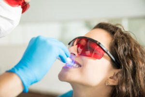 Clareamento dental na Mooca: mitos, sensibilidade e quanto dura